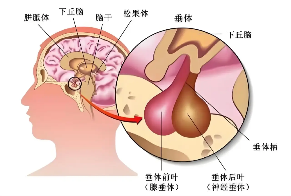 腦瘤≠癌癥！原發性與繼發性腦瘤的核心區別