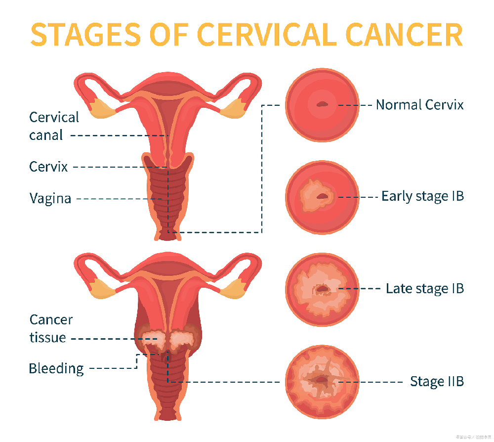 別忽視！女性常見的10種子宮疾病，危害遠超想象