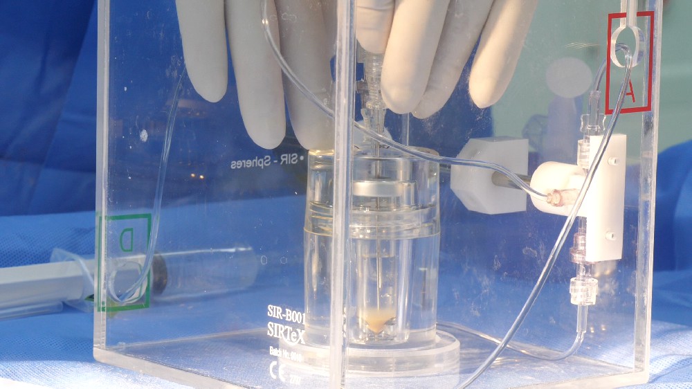 肝癌新療法釔 - 90：常見疑問一次性解答