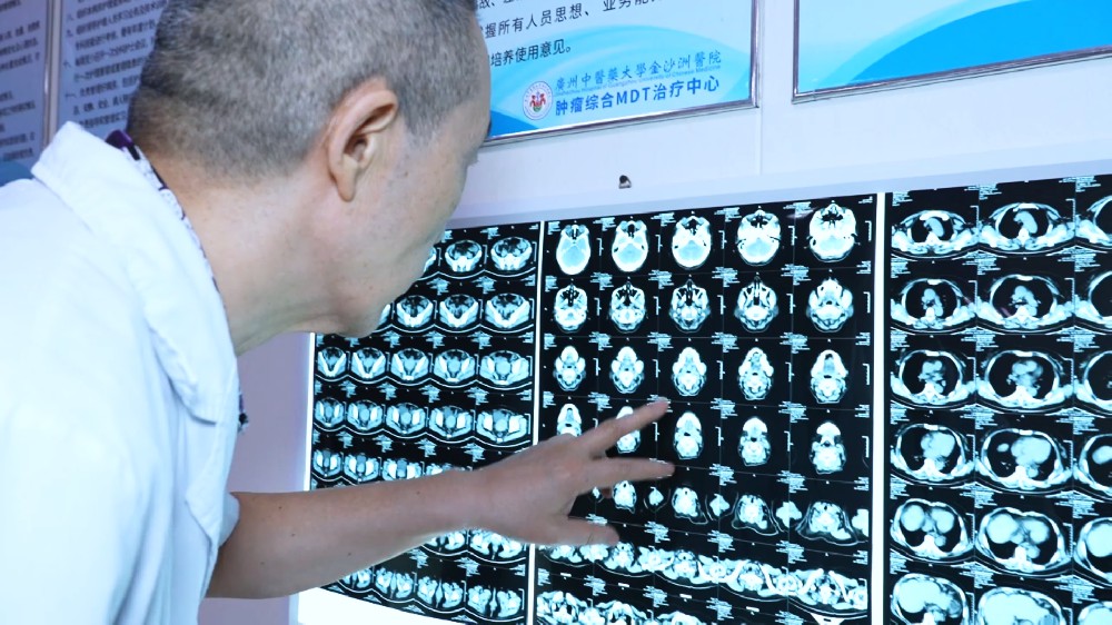 化療真的那麽可怕？腫瘤科王立根醫生戳破4個常見誤解，帶妳走出認知誤區！